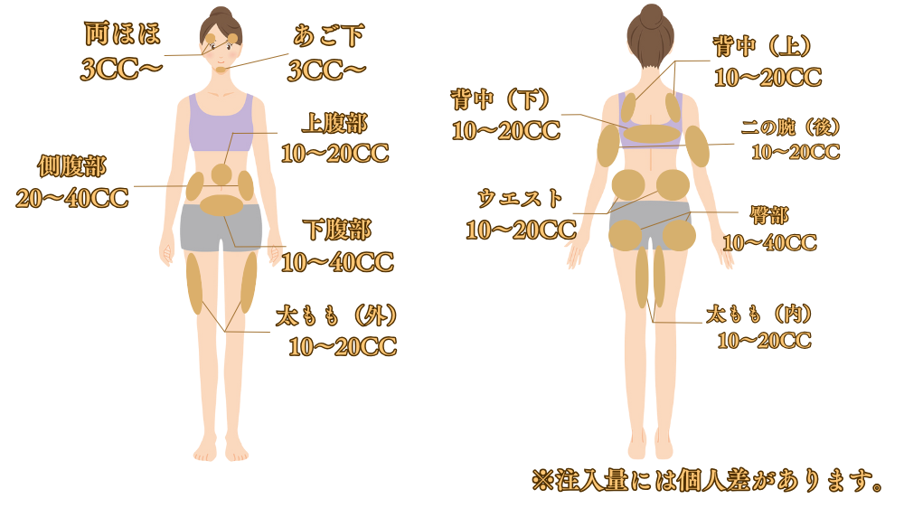 脂肪溶解注射