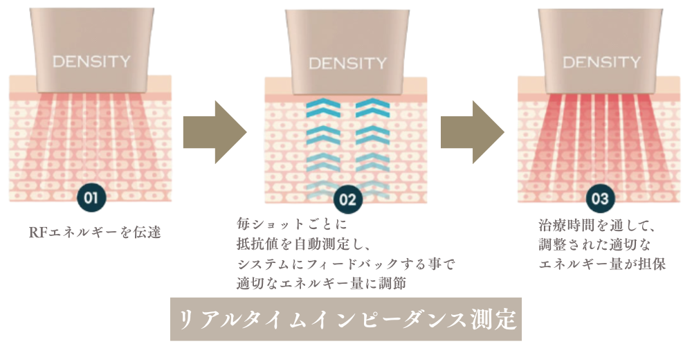デンシティ