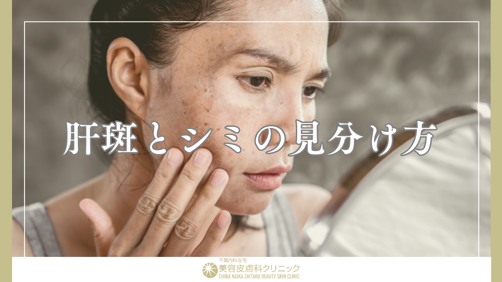 肝斑