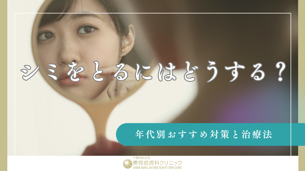 シミ