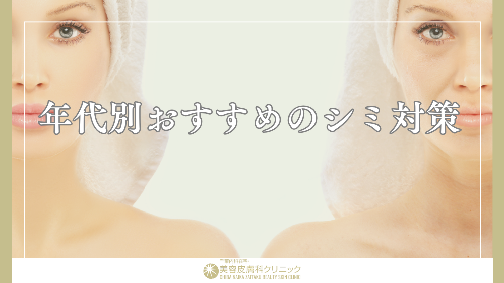 シミ
