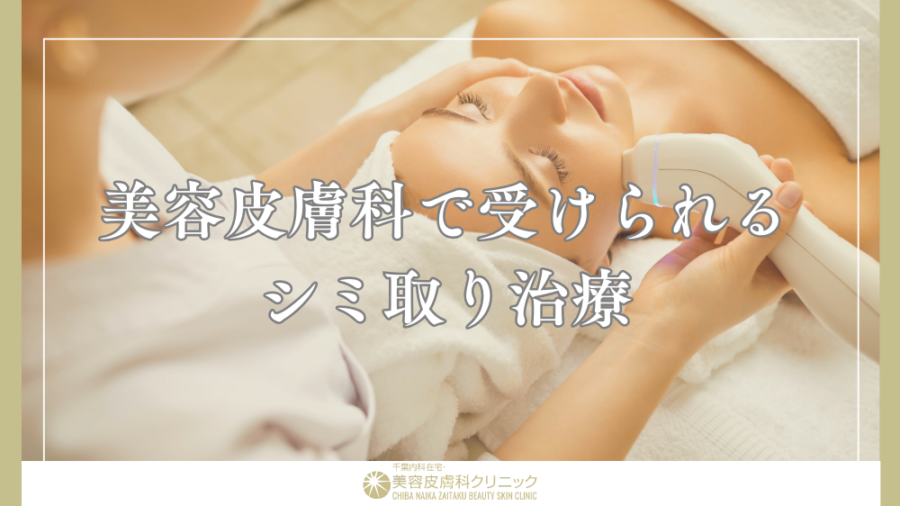 シミ