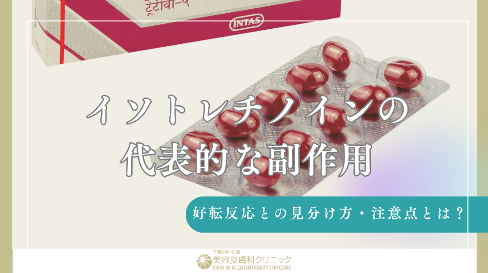 イソトレチノイン