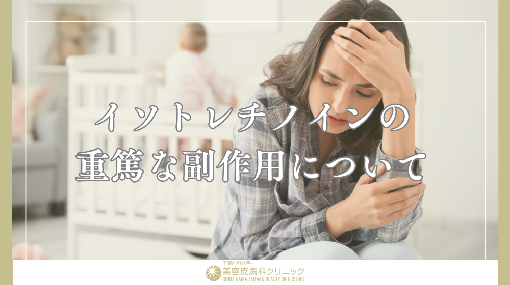 イソトレチノイン