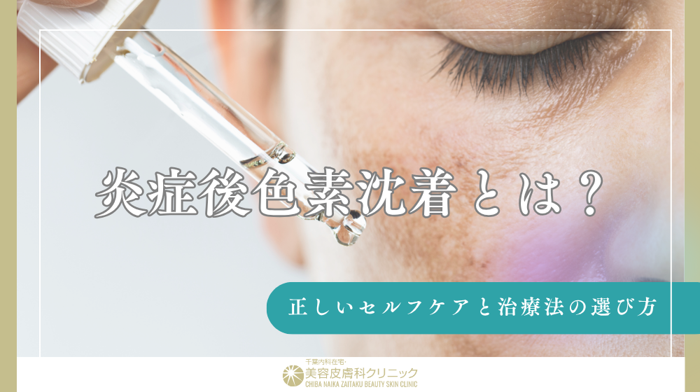 炎症後色素沈着
