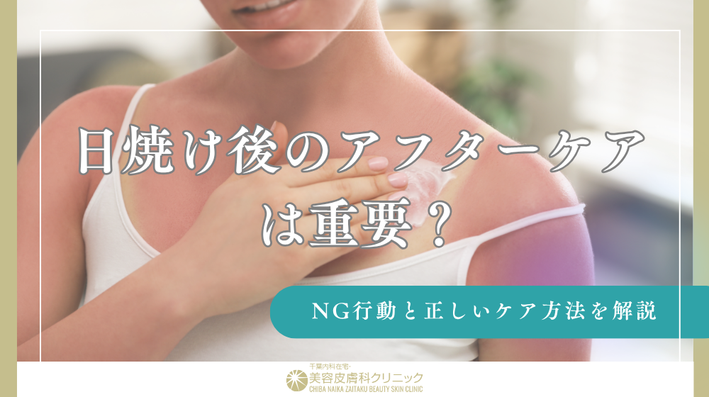 日焼け後のアフターケアは重要？NG行動と正しいケア方法を解説