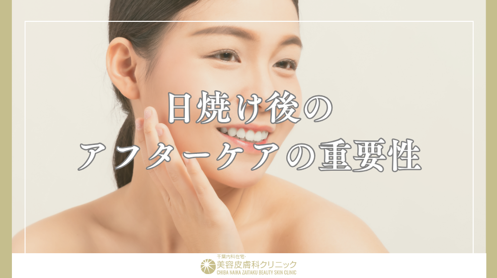 日焼け後のアフターケアは重要？NG行動と正しいケア方法を解説