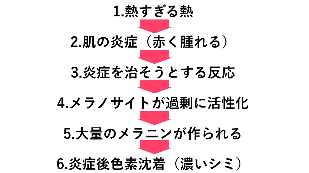 フォトフェイシャルによる肝斑治療|濃くなる原因と失敗しない機械選び