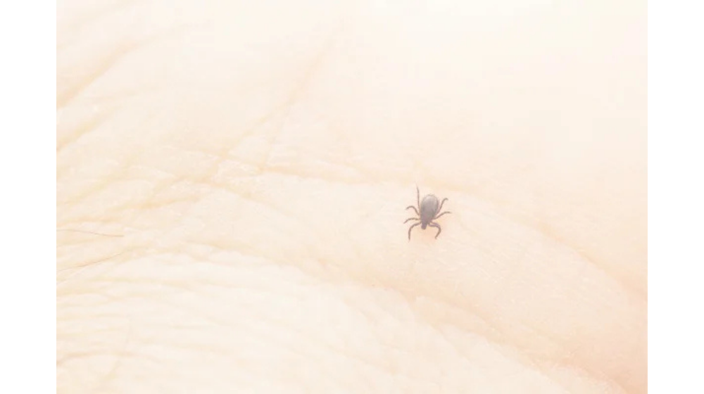 虫刺されのかゆみが止まらない人必見｜対処法やぶり返す可能性はある？