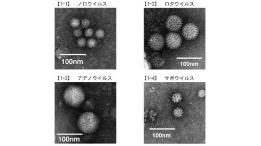 大人のウイルス性・細菌性の胃腸炎の原因や症状、改善方法｜嘔吐や下痢の原因？
