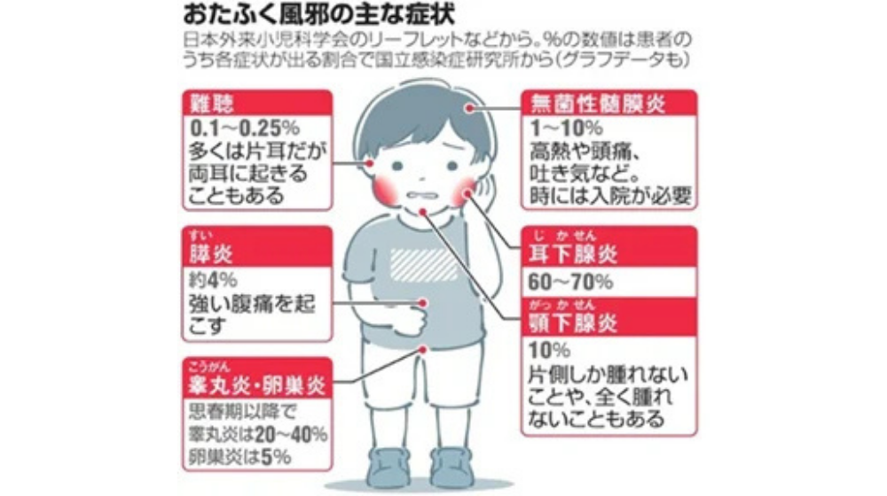 おたふく風邪の初期症状は?原因や感染経路、合併症について解説