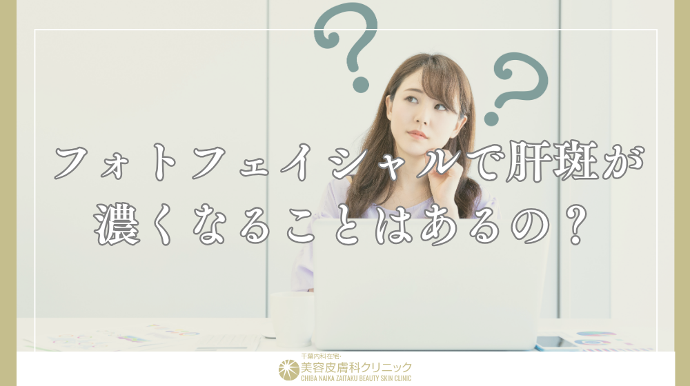 フォトフェイシャルによる肝斑治療|濃くなる原因と失敗しない機械選び