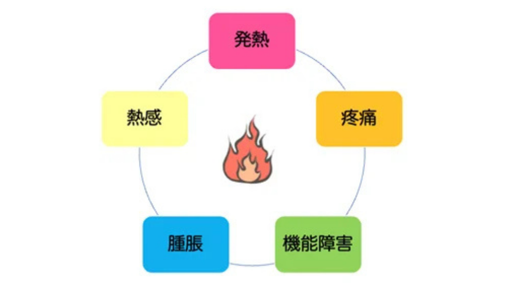 急性扁桃炎の症状や早く治す方法を解説｜急性咽頭炎との違いは？