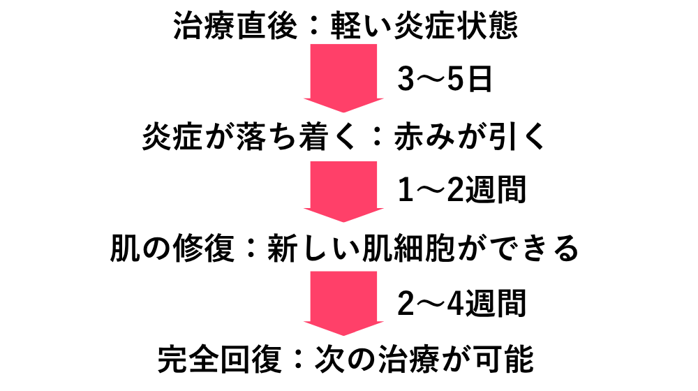 フォトフェイシャルによる肝斑治療|濃くなる原因と失敗しない機械選び