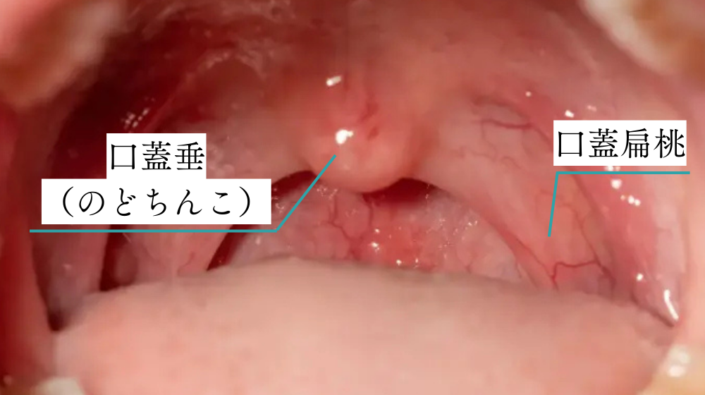 喉に刺さった魚の骨の対処方法や、喉の骨を放置しても大丈夫？病院行くべき？何科？子供は？について解説