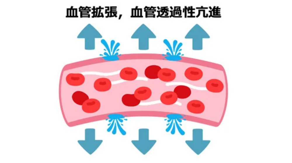 急性扁桃炎の症状や早く治す方法を解説｜急性咽頭炎との違いは？