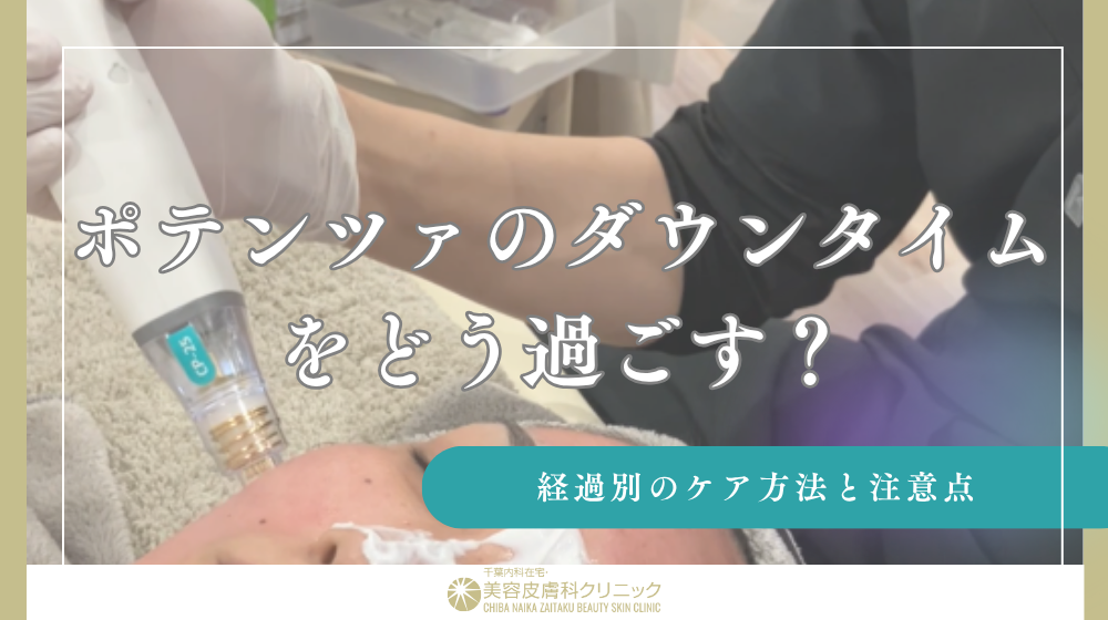 ポテンツァのダウンタイムをどう過ごす?経過別のケア方法と注意点