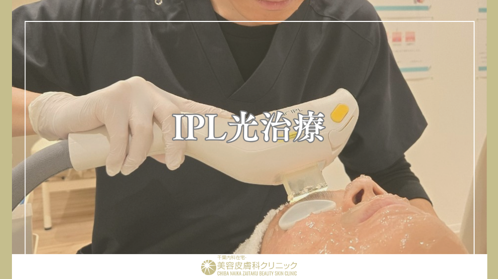 毛穴治療でおすすめの施術は?人気美容施術の種類と注意点を解説