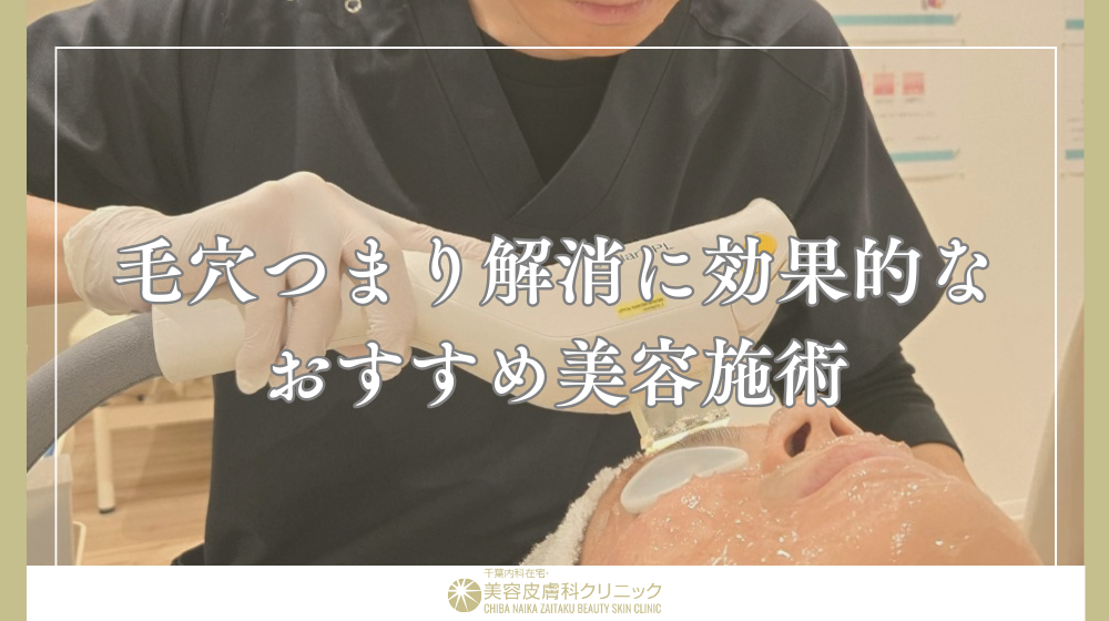 毛穴づまりを正しく解消する方法は?肌質別ケアとNG行為を解説